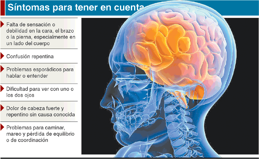 img- representa a la noticia publicada. 